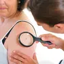 Sempre più casi di scabbia nell'Ulss 3