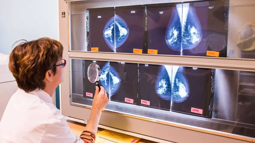 La lettura di un esame mammografico