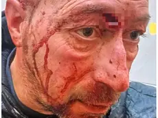 Ivan Panizzolo ferito e a destra la sera dell'aggressione