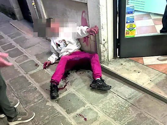 Il ferito a terra subito dopo l'accoltellamento (foto Interpress)