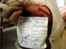Una sacca di sangue utilizzata per le trasfusioni