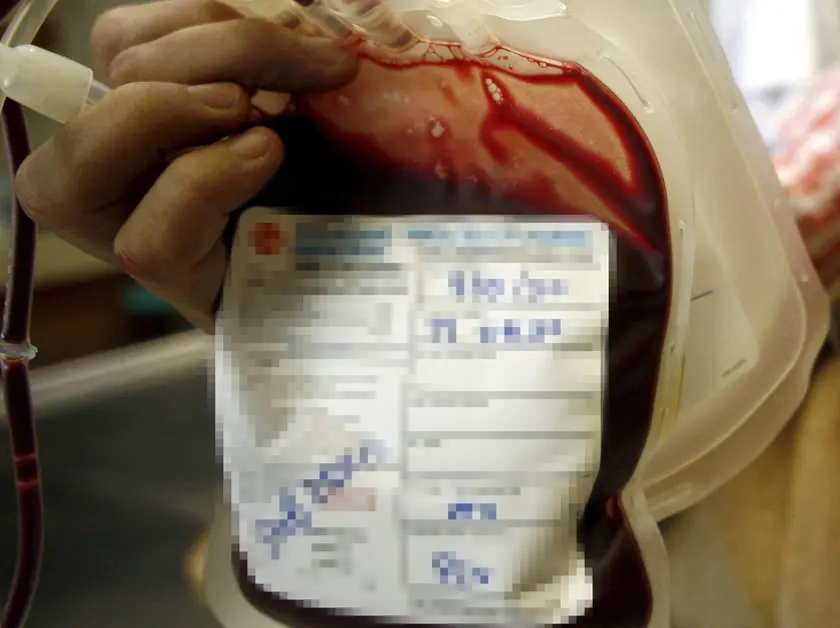 Una sacca di sangue utilizzata per le trasfusioni