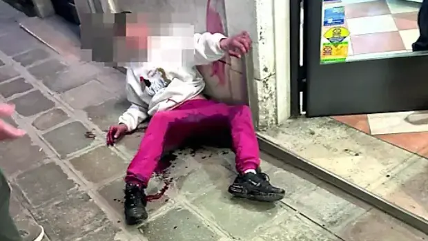 L'uomo ferito nell'accoltellamento a San Barnaba