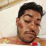 Kashem Rakib morto dopo il pestaggio