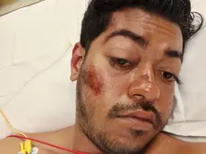 Kashem Rakib morto dopo il pestaggio