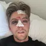 Daniel Fontana, cuoco bellunese aggredito a Jesolo