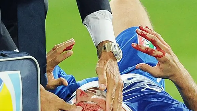 Defender of Italy, Manuel Pasqual, injured during the FIFA World Cup 2014 qualification match Italy vs Czech Republic at Juventus Stadium in Turin, Italy, 10 September 2013. ANSA/DI MARCO.