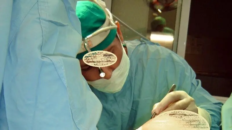 Un intervento di plastica al seno (foto generica)
