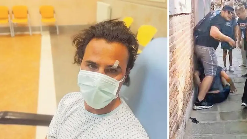 Diego Nason dopo le medicazioni in ospedale. A destra un momento del pestaggio in fondamenta San Trovaso